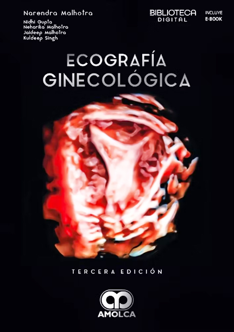 ECOGRAFIA GINECOLOGICA